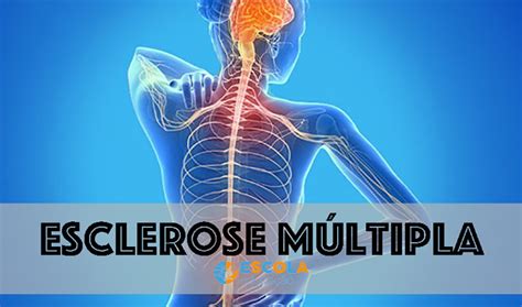 Esclerose Múltipla: Diagnóstico, Sintomas e Tratamento.